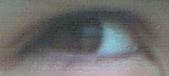 My Eye
