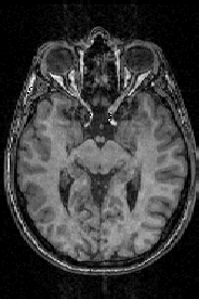 neurotica