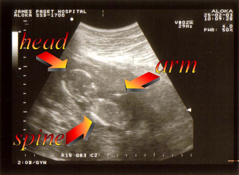 this is the best pic we could get as baby kept wriggling