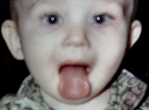 Is my tounge red?