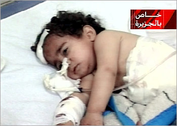 Ni�a herida en un Hospital de Iraq