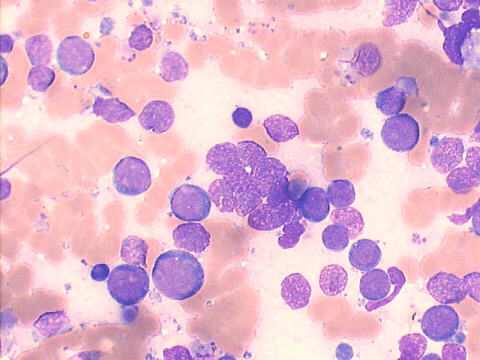 500x Giemsa staining