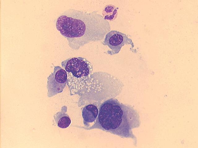 500x Giemsa staining