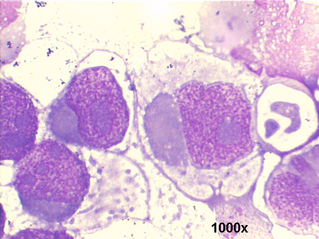 1000x M-G-G staining