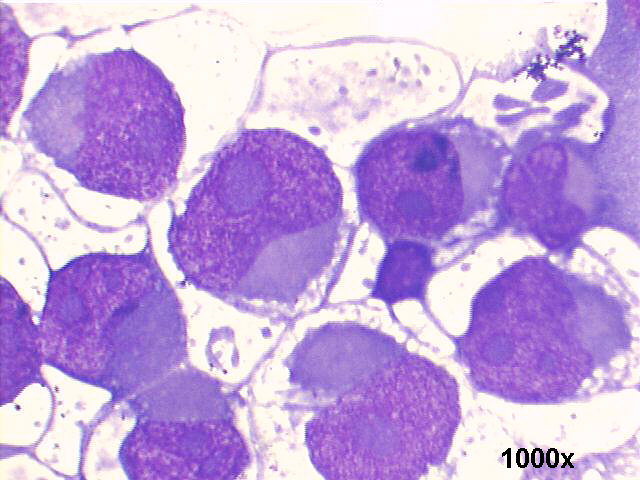 1000x M-G-G staining