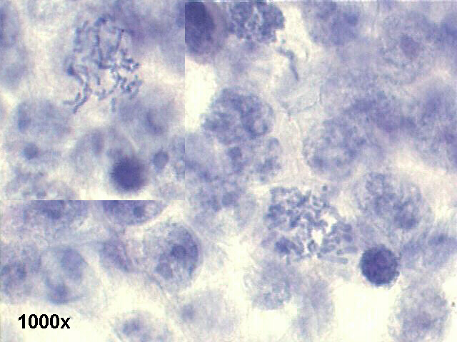 1000x Pap staining