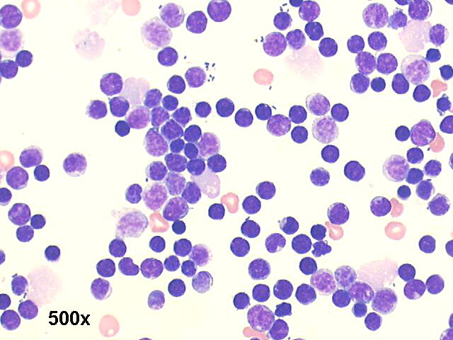 200x Papanicolaou staining