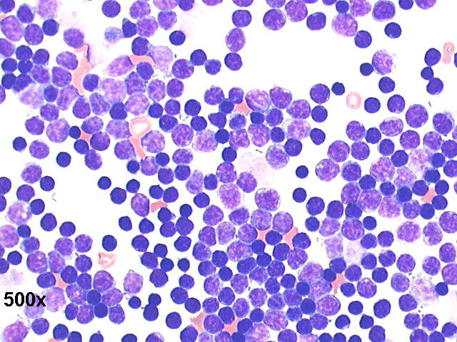 500x Papanicolaou staining