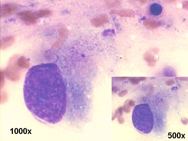 1,000x and 500x M-G-G staining