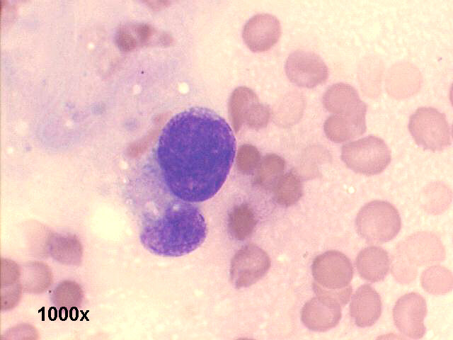 1,000x M-G-G staining