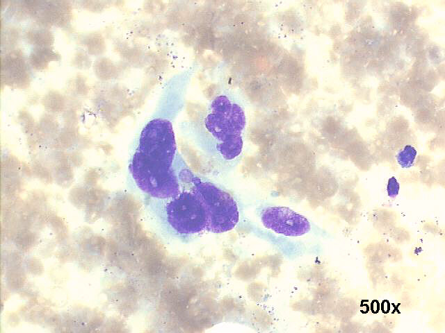 500x M-G-G staining