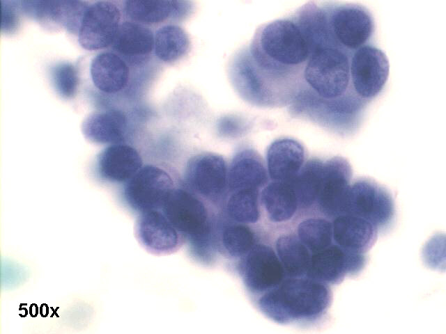 500x Papanicolaou staining