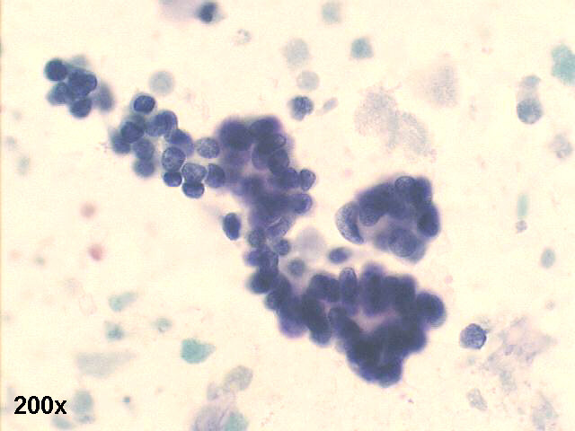 200x, Papanicolaou staining