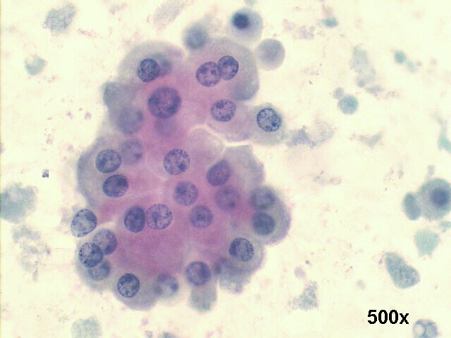 500x Papanicolaou staining