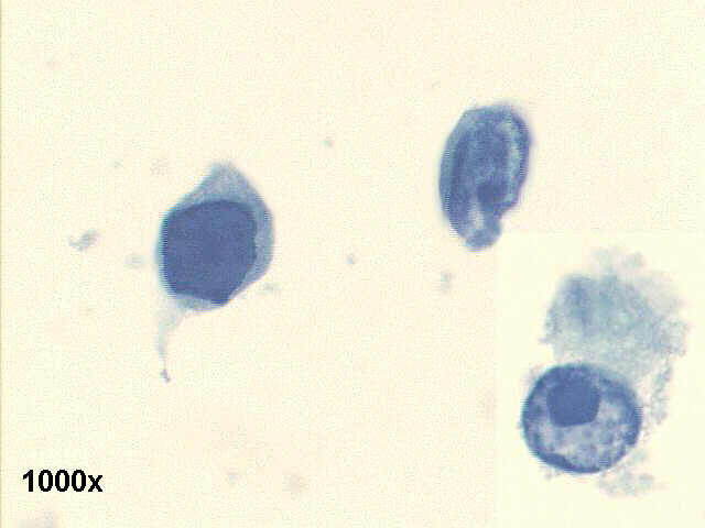 Pap staining 1,000x