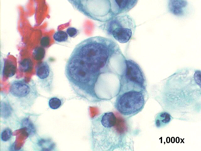 1000x Pap staining