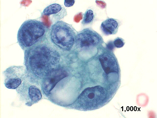 1000x Pap staining