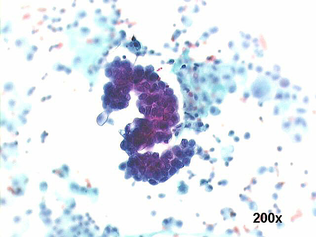 200x Pap staining