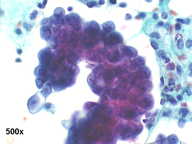 500x Pap staining