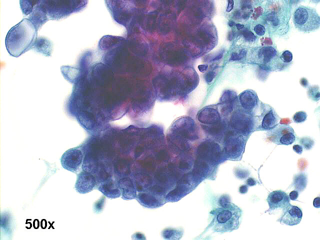 500x Pap staining