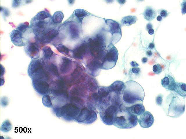 500x Pap staining