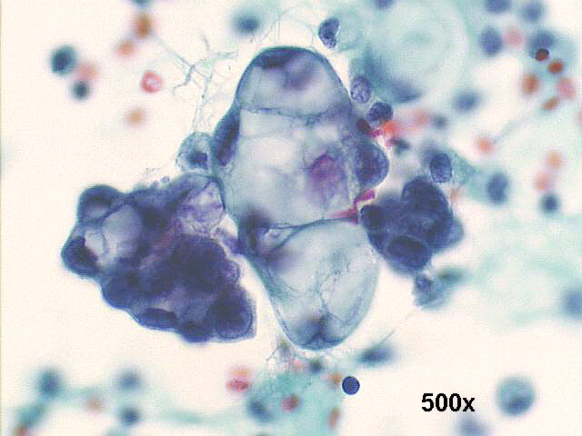 500x Pap staining