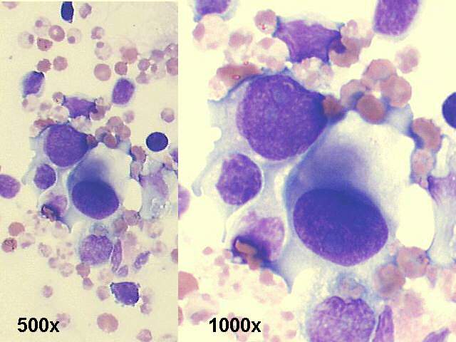 500x and 1000x M-G-G staining