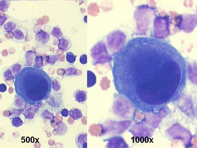 500x and 1000x M-G-G staining