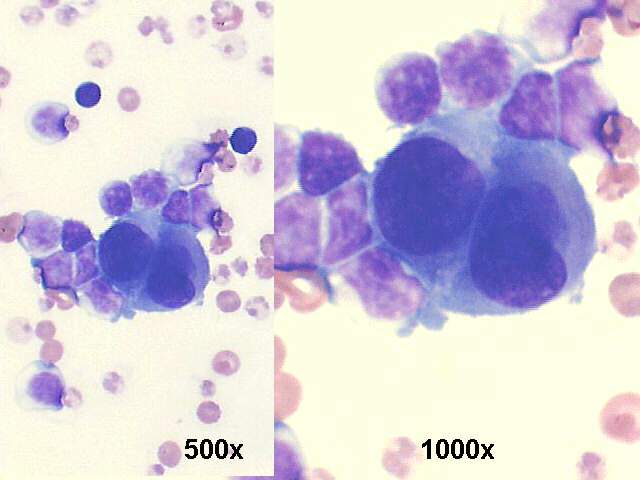 500x and 1000x M-G-G staining
