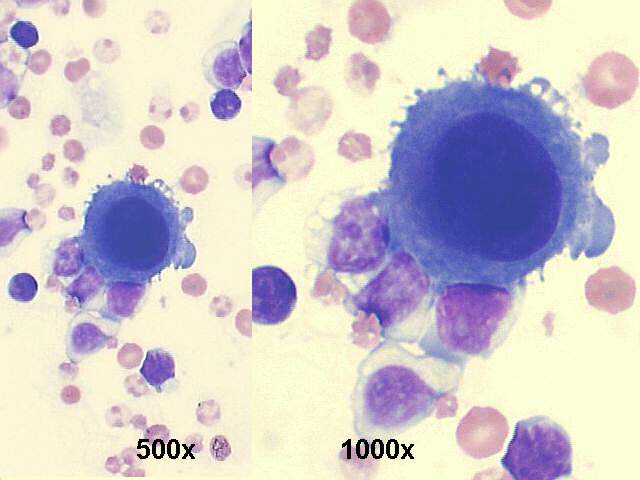 500x and 1000x M-G-G staining