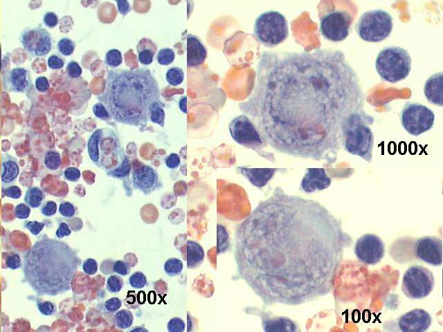 500x and 1000x Pap staining