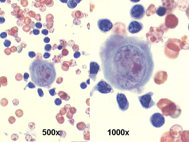 500x and 1000x Pap staining