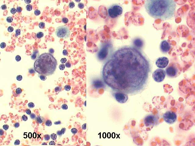 500x and 1000x Pap staining