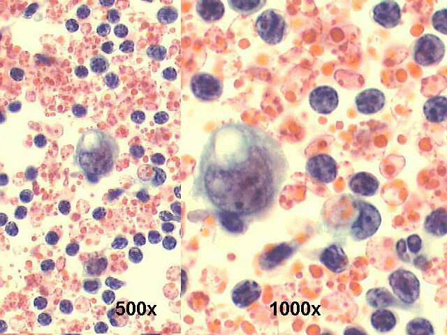 500x and 1000x Pap staining