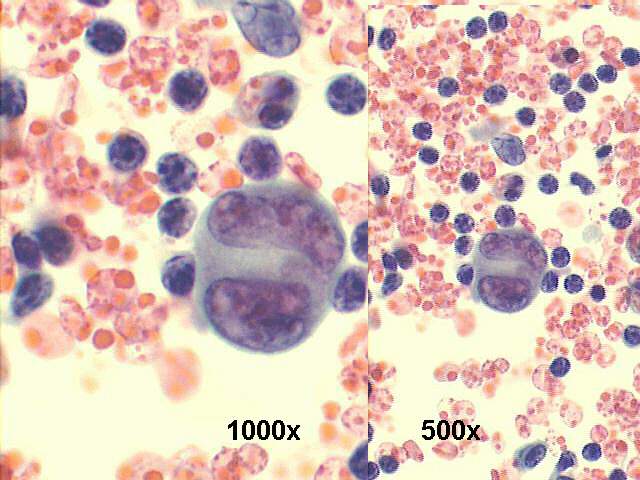 500x and 1000x Pap staining