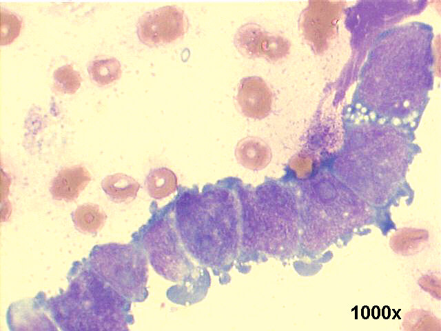 1000x M-G-G staining