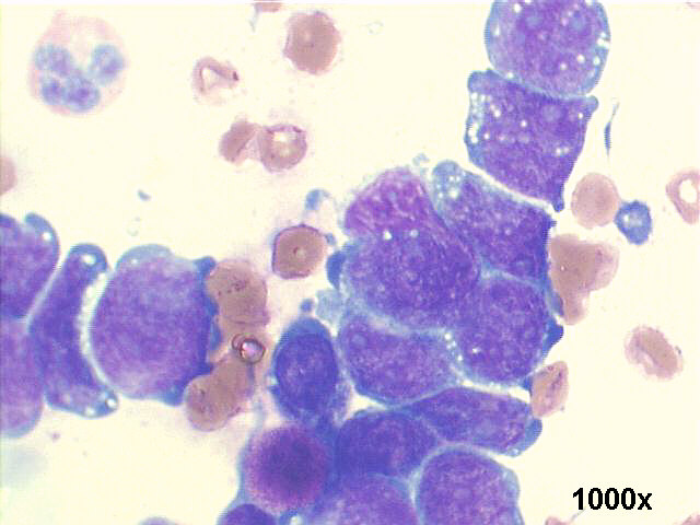 1000x M-G-G staining