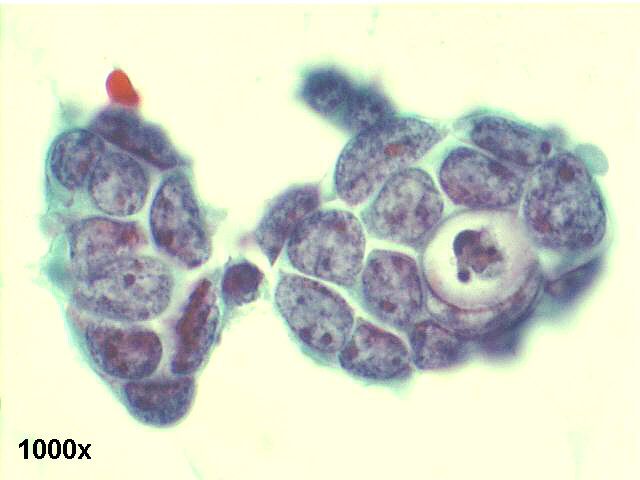 1000x Papanicolaou staining