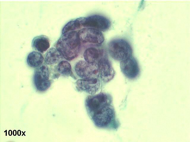 1000x Papanicolaou staining