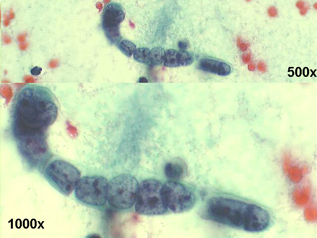 500x and 1000x Papanicolaou staining