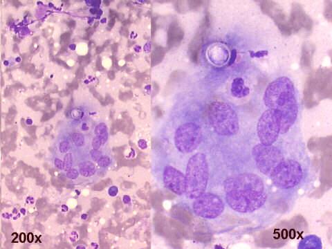 200x and 500x M-G-G staining