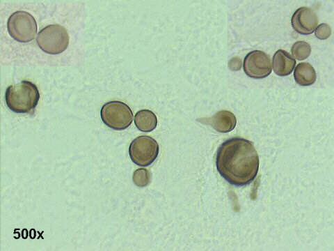 500x Gomori silver staining, round budding yeasts, of variable size, refractile walls.