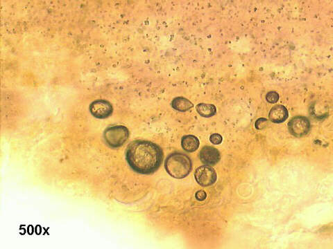 500x Gomori silver staining, round budding yeasts, of variable size, refractile walls.