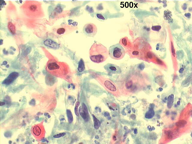 500x Papanicolaou staining
