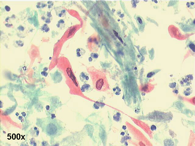 500x Papanicolaou staining