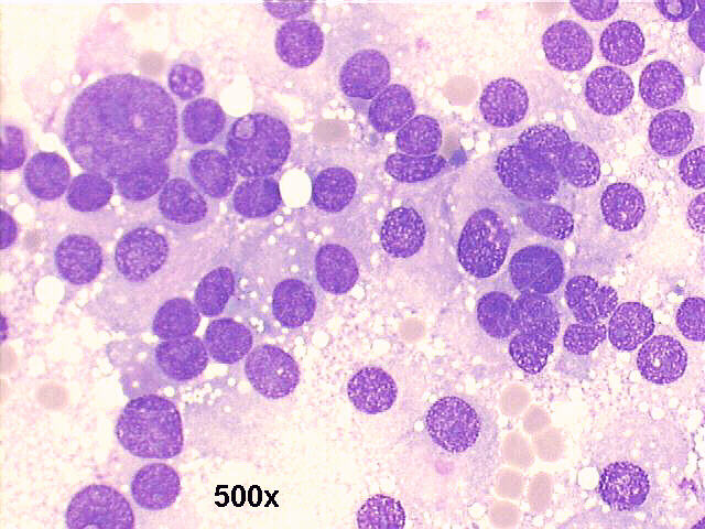M-G-G staining, 500x