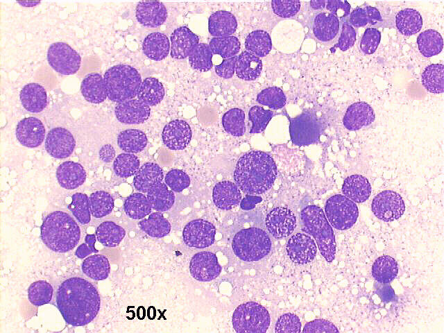 M-G-G staining, 500x