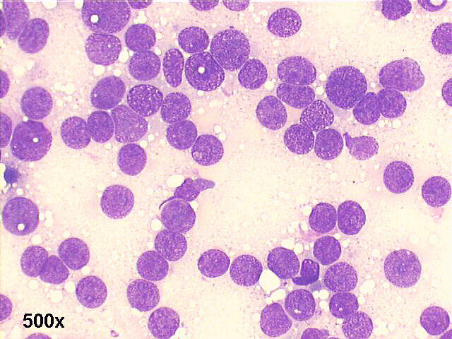 M-G-G staining, 500x