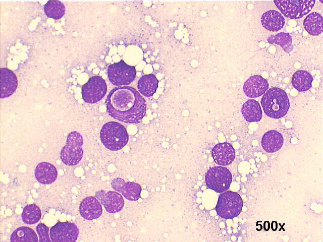 M-G-G staining, 500x