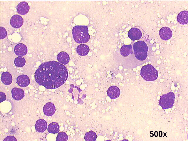 M-G-G staining, 500x
